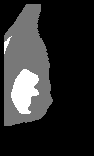 \includegraphics[height=3.45 cm]{images/sdb041ll.b2.eps}