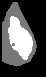 \includegraphics[height=3.45 cm]{images/sdb194rl.b3.eps}